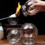 Cupping Therapy